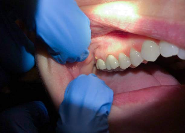 Best Teeth Whitening  in Romeo, MI