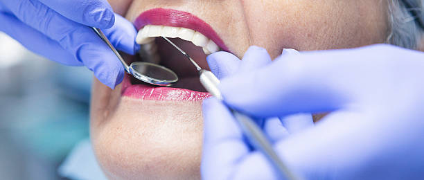 Best Chipped Tooth Repair Near Me  in Romeo, MI